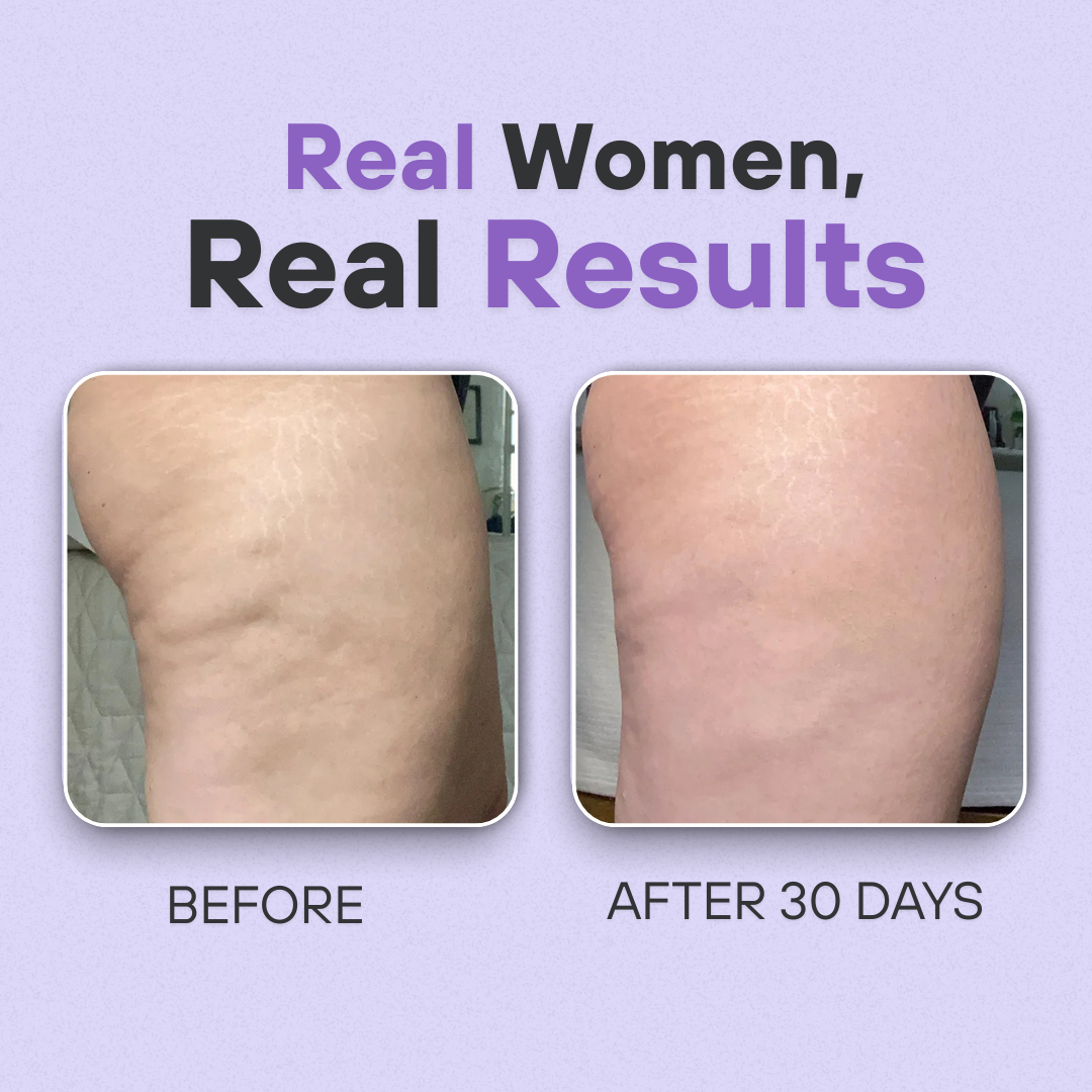 Overnight Cellulite Eraser & Booty Toner