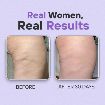 Overnight Cellulite Eraser & Booty Toner