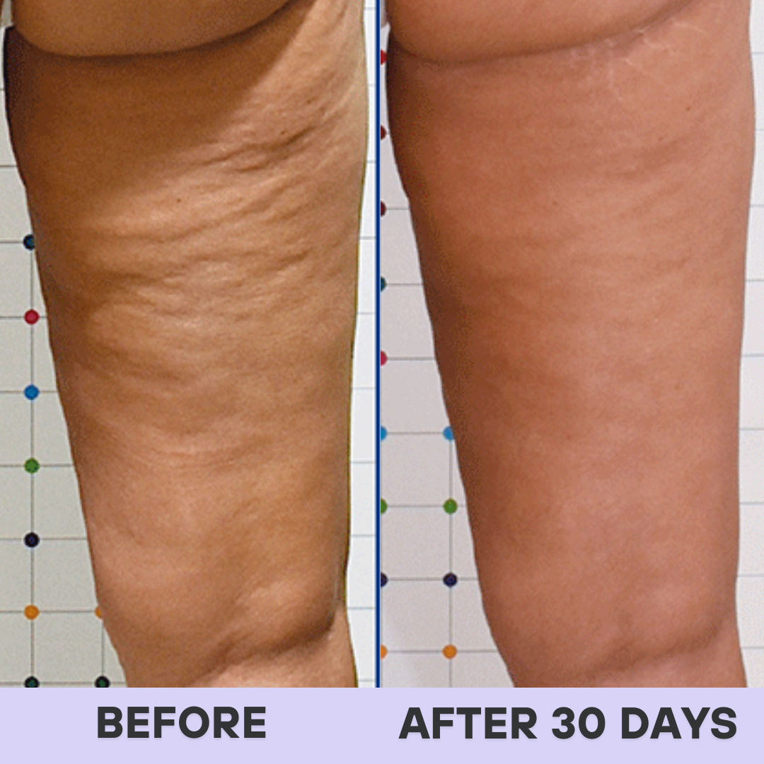 Overnight Cellulite Eraser & Booty Toner