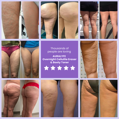 Overnight Cellulite Eraser & Booty Toner